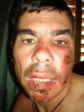 face plant crash-motorbike-002